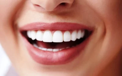 Ketahui 5 Cara Memutihkan Gigi dengan Bahan Alami yang Ada di Rumah